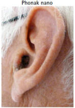 незаметный слуховой аппарат