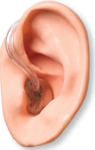 для слухового аппарата необходим ушной вкладыш